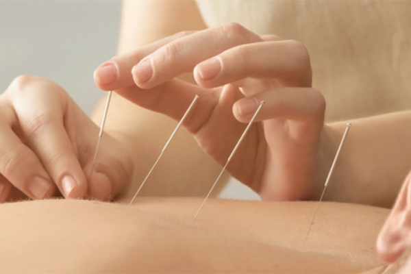 لاغری با کاشت نخ