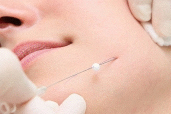 عوارض کاشت نخ لاغری