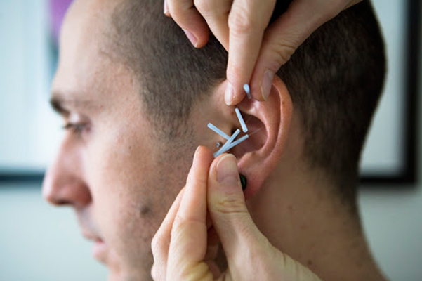 عوارض کاشت نخ لاغری
