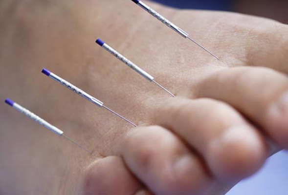 عوارض کاشت نخ لاغری