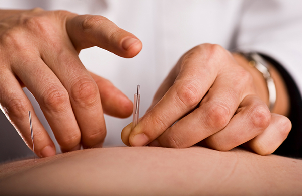 افزایش قد با کاشت نخ و طب سوزنی