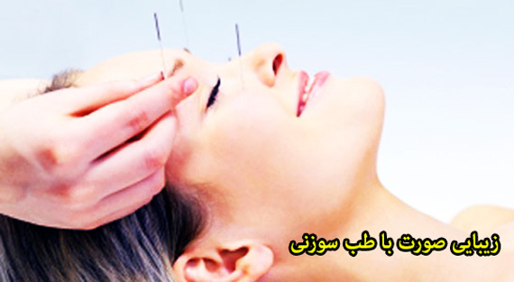 طب سوزنی جایگزین بوتاکس